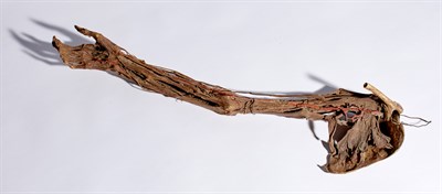 Lot 155 - Medically Prepared Human Arm Late 19th century...