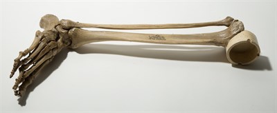 Lot 159 - Human Leg and Foot Bone Ashtray Signed Darwin...