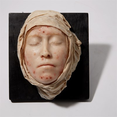Lot 163 - Contemporary Wax Model of a Diseased Face By...