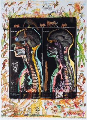 Lot 216 - BEARD, PETER (1938-2020) [MRI-IRM] Another...