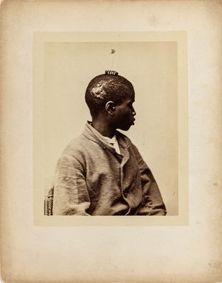 Lot 302 - A startling medical photograph of a young African American boy