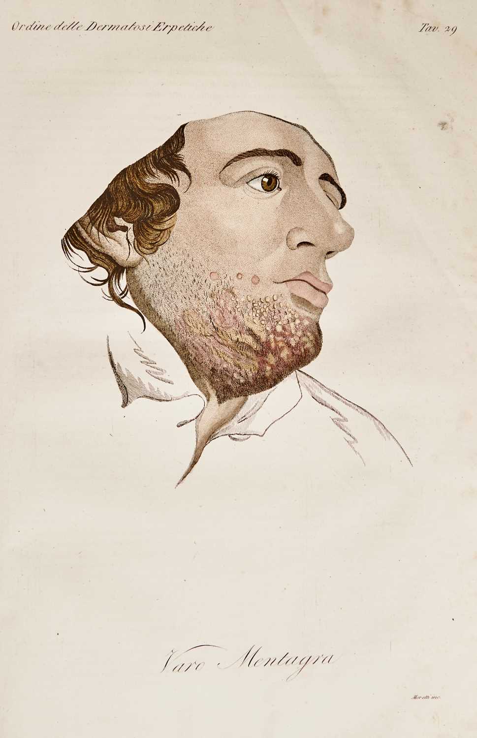 Lot 61 - The Italian translation of Alibert on skin disease