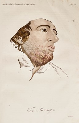 Lot 61 - The Italian translation of Alibert on skin disease